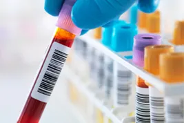 photo of blood sample in test tube