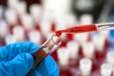 photo of blood test