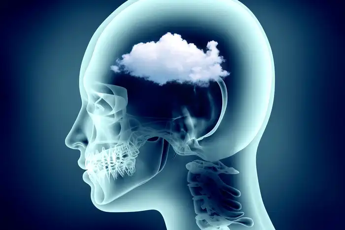 photo of brain fog