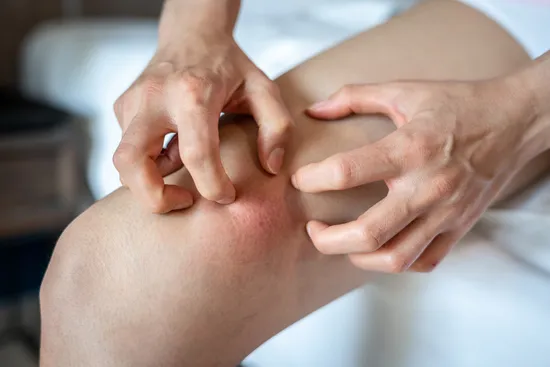 photo of scratching leg