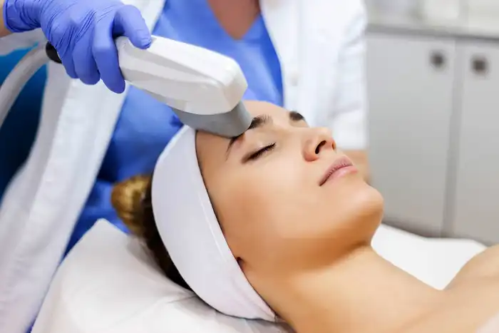 photo of ipl treatment