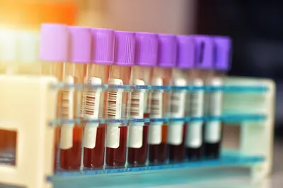photo of blood samples