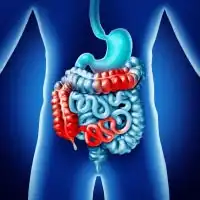 photo of crohn's disease anatomy