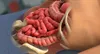 intestine illustration