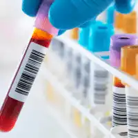 photo of vial of blood